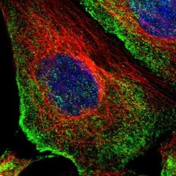 ODR4/TTG1 Antibody, Novus Biologicals:Antibodies:Primary Antibodies